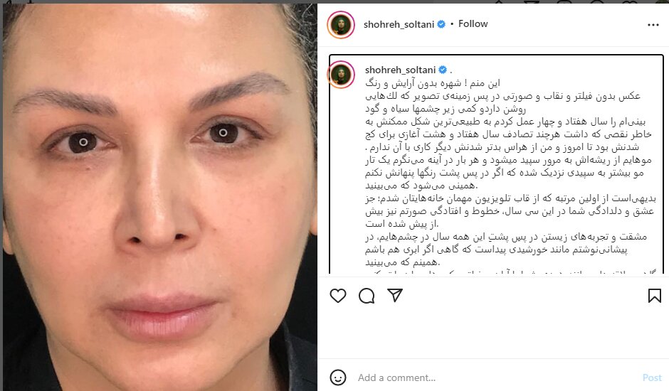 شهره سلطانی: با همین چین و شکنها و افتادگی صورت بشناسیدم/ عکس