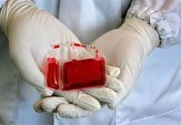 ۱۵۰۰ نمونه خون بند ناف نوزاد در لرستان ذخیره‌سازی شد